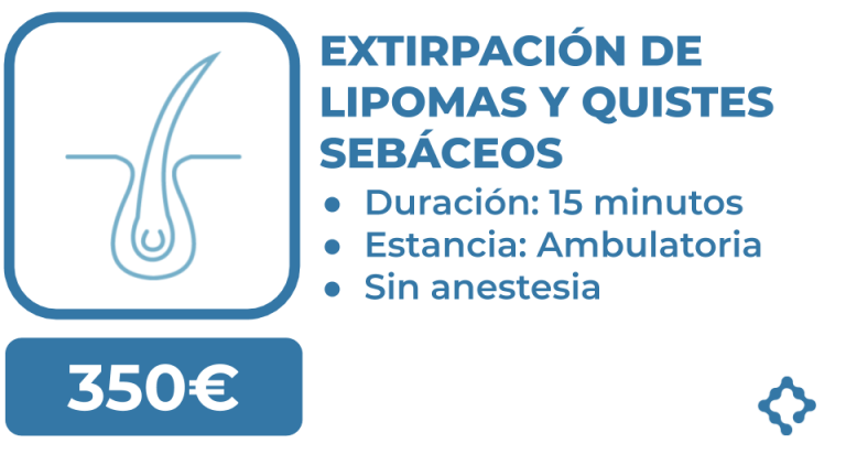 precio extirpacion lipomas y quistes sebaceos