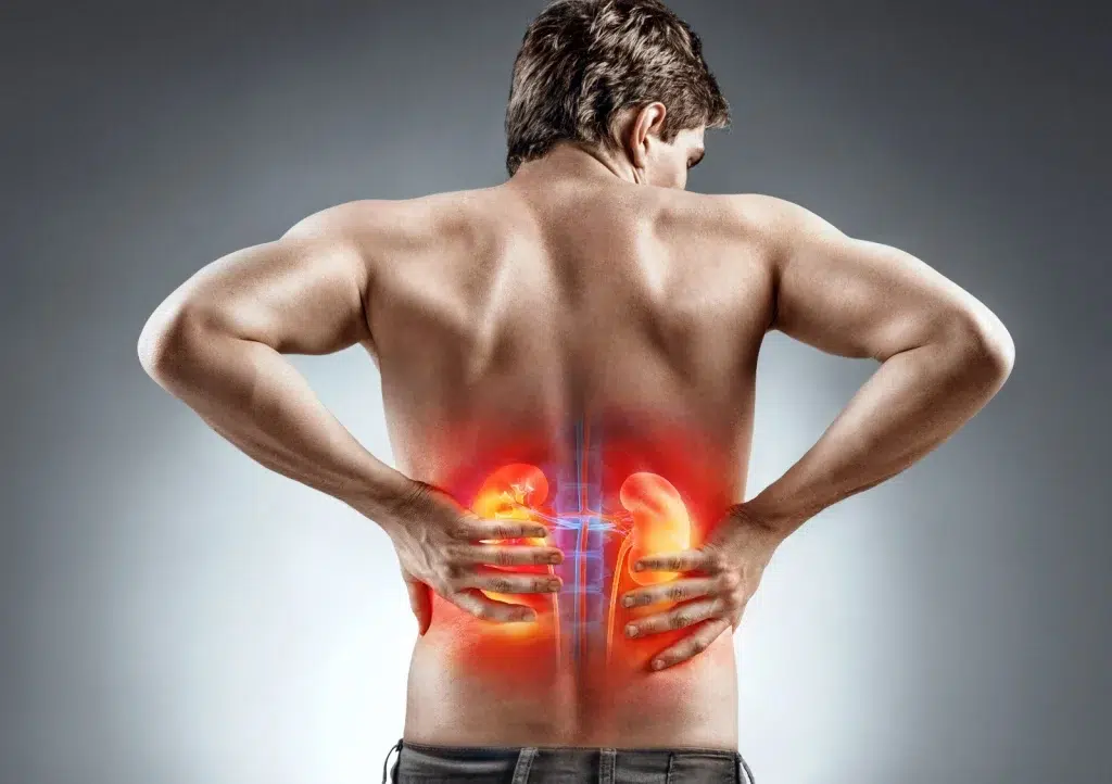 diferencias-entre-dolor-lumbar-y-dolor-de-riñones