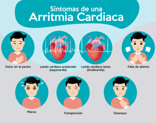arritmia_cardiaca_sintomas