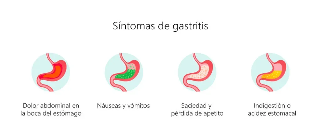 gastritis-cronica-sintomas