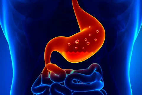 gastritis-cronica
